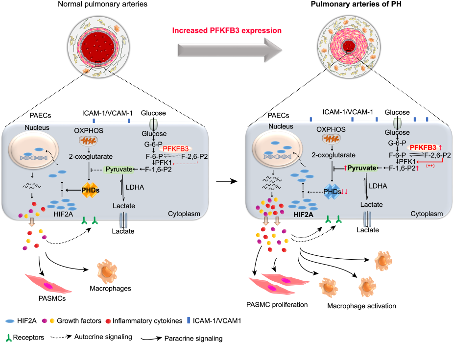内皮细胞中PFKFB3介导的糖酵解对肺动脉高压发展的影响模式图.png
